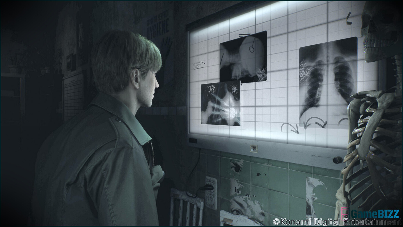 Bloober Team beschuldigt Konami für das Fehlen von Silent Hill 2 Remake News